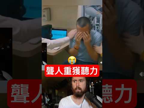 醫生：恭喜你恢復聽力！ 他：拜託拆掉? thumbnail
