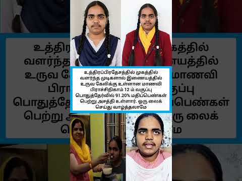 பாராட்ட மனம் இருந்தால் ஒரு லைக் போடுங்க #shorts thumbnail