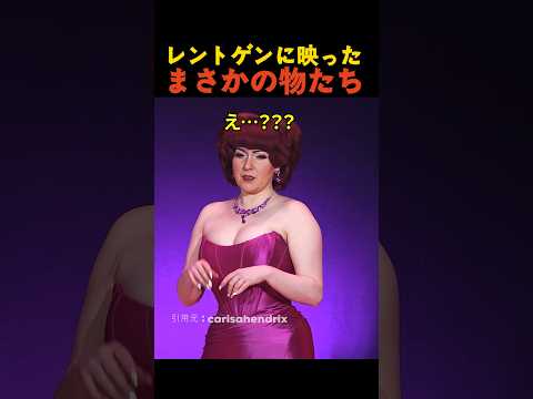 レントゲンに映ったまさかの物たち thumbnail