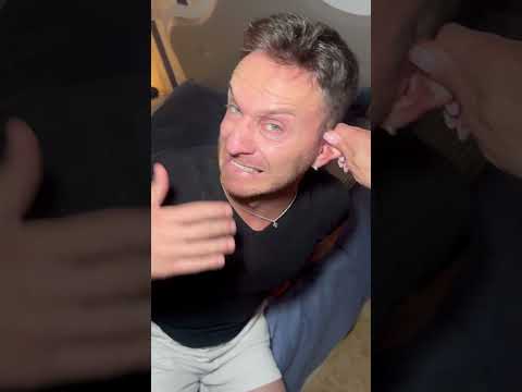 MA CHI ME L’HA FATTO FA🤦‍♂️😜 #congiuntiimperfetti #shortvideo #impiastro thumbnail