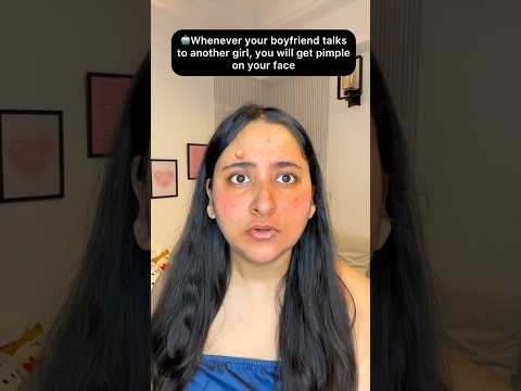 Whenever your boyfriend talks to another girl, you will get pimple on your face #funnyshorts #shorts thumbnail