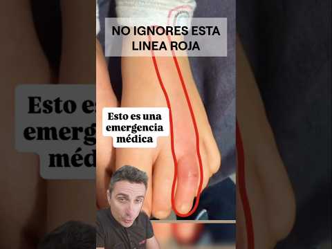 No ignores esta línea roja.#supervivencia #curiosidades #sabiasque thumbnail