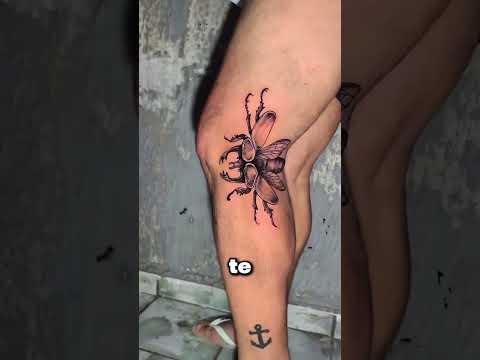 Vio un Monstruo Gigante en la Rodilla de Su Hermano… y Nadie Se Atrevía a Tocarlo ? thumbnail