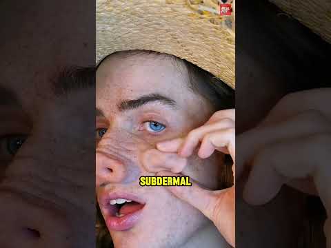 Laba-laba Di Bawah Kulit thumbnail