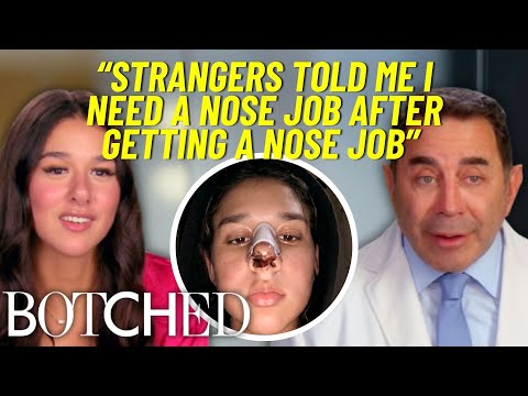 Nose Job At 17 Gone Wrong?! Doctors Fix Jasmine’s Botched Rhinoplasty | Botched | E! thumbnail