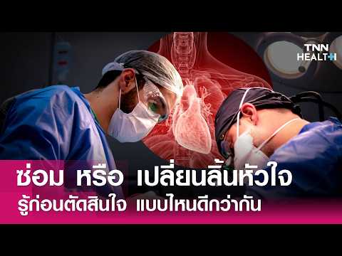 รู้ก่อนตัดสินใจ ซ่อมหรือเปลี่ยนลิ้นหัวใจ แบบไหนดีกว่ากัน : TNN Health thumbnail
