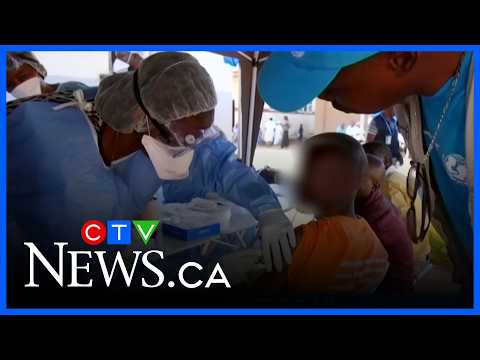 Ebola outbreak in Africa continues thumbnail