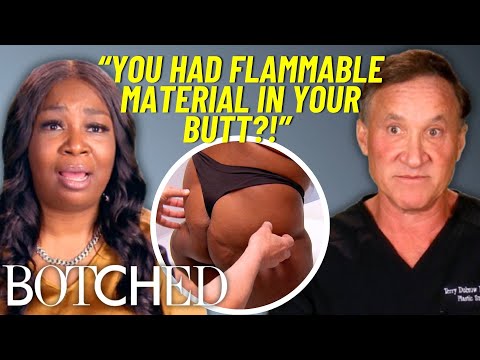 Shekea's Botched BBL Caught On FIRE During Surgery (Before & After) | Botched | E! thumbnail