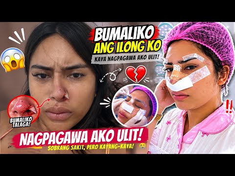 AKSIDENTENG NAAPAKAN NI MERFECT YONG ILONG KO! Sobrang sakit thumbnail