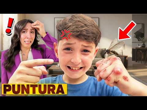 FIGLIODIEGO E' STATO PUNTO ALLA GUANCIA DA UN PAPPATACIO , FINISCE IN OSPEDALE! thumbnail