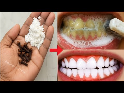 The recipe that dentists are hiding from us🔥!It whitens teeth and eliminates tartar in 1 minutes. thumbnail