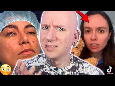 This Eye Colour Plastic Surgery Is Getting WORSE thumbnail