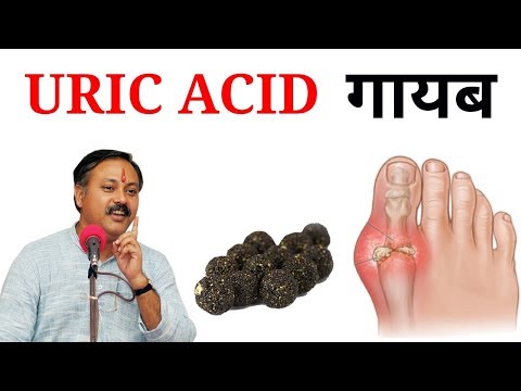 Uric Acid Treatment || Uric acid kaa ilaj Hindi me || Gout thumbnail