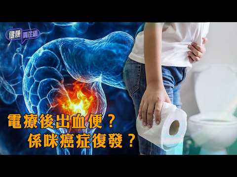 電療後出血便？係咪癌症復發？ ｜ 健康關注組 ｜ EP578 ｜ 放射性直腸炎 ｜ 血便 ｜ 盆腔電療 ｜ 癌症復發 ｜ 黃芳雯 ｜ 朱智賢 ｜ HOY thumbnail