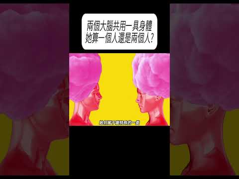 兩個大腦共用一具身體，她算一個人還是兩個人?#科普 #漲知識 thumbnail