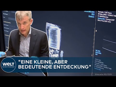 POMPEJI: Arztkoffer im Aschestaub! CT enthüllt sensationellen Fund eines Vesuv-Opfers thumbnail