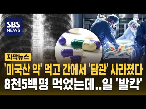 '미국산 약' 먹고 간에서 '담관' 사라졌다..8천5백명 먹었는데 일 '발칵' (자막뉴스) / SBS thumbnail