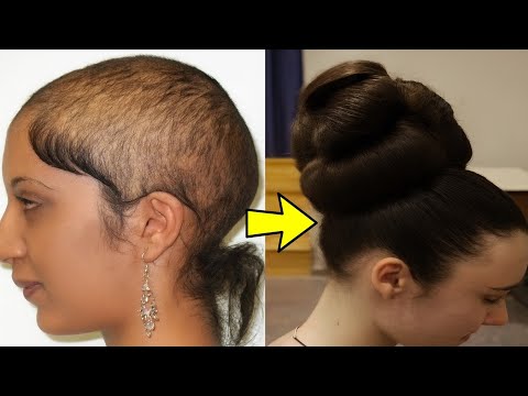 hair grows like crazy and doesn't fall out, an old grandmother's recipe! thumbnail