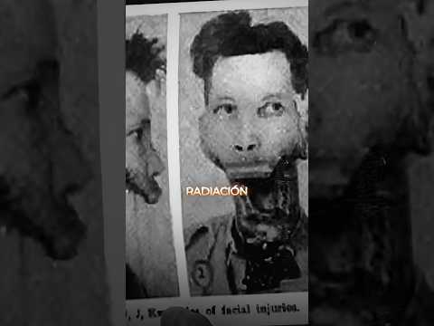 El hombre sin mandíbula 💀 #Terror #historia #radiathor thumbnail