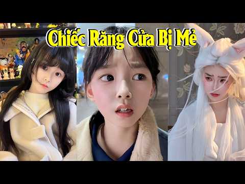 🎭 Chiếc Răng Cửa Bị Mẻ 🦷😂 thumbnail
