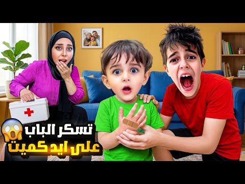 كموتة تسكر الباب على ايدو😱ايدو انتفخت وأخذنا اسعاف 🚨 خلودة كتير زعل عليه🥲 thumbnail