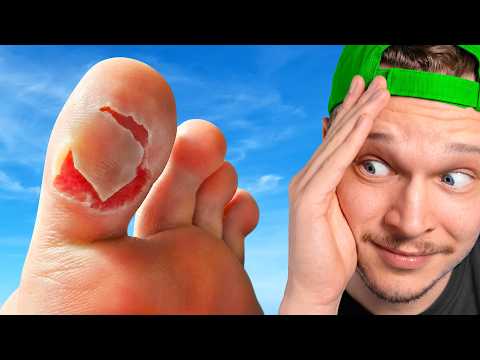 Essayez de ne pas Skip !  thumbnail