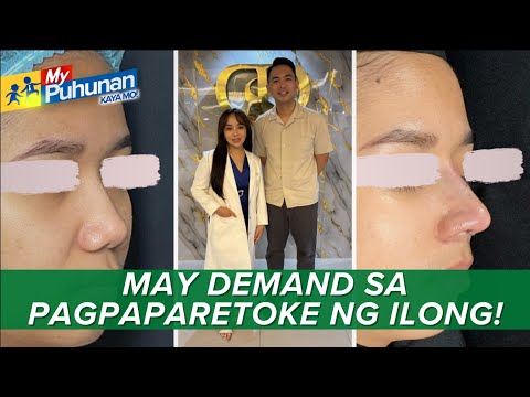 Mga Pinoy na gustong magpagawa ng ilong, dumarami! | My Puhunan: Kaya Mo! thumbnail