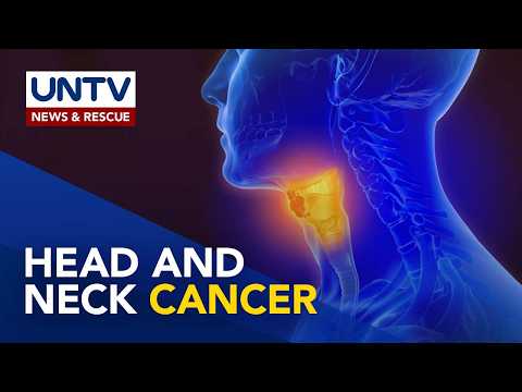 ALAMIN: Early warning signs ng Head and Neck Cancer | Usapang Pangkalusugan thumbnail