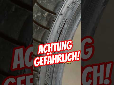 Zufallsbefund: (Lebens)gefährlicher RISS! thumbnail