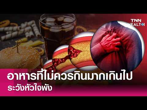 เปิดรายชื่อ อาหารที่ไม่ควรกินมากเกินไป ระวังหัวใจพัง : TNN Health thumbnail