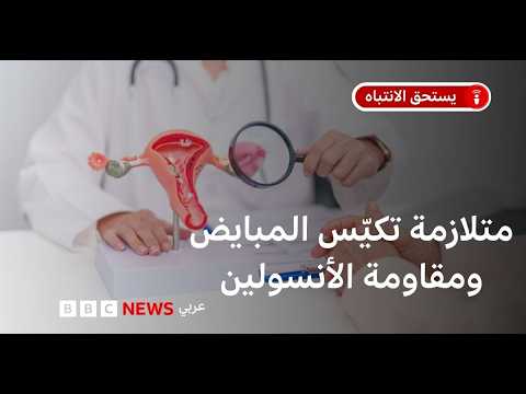 لماذا تغيّرت تسمية متلازمة تكيّس المبايض؟ thumbnail