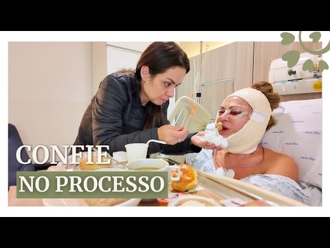 24 HORAS PÓS CIRURGIA NO ROSTO - FLAVIA CALINA  thumbnail