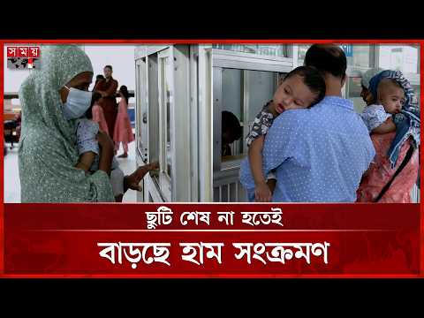 ডিএনসিসি হাসপাতালে রোগী ভর্তি না নেয়ার অভিযোগ | Measles Outbreak | Eid Holiday | Somoy TV thumbnail