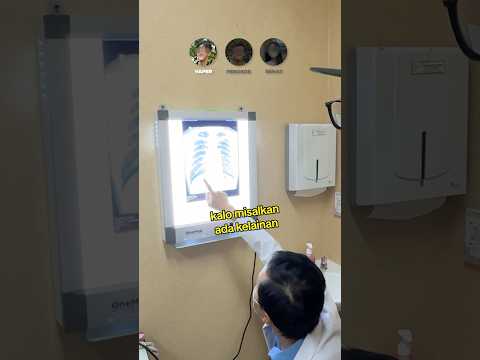 Hasil XRAY paru2 vape, rokok, dan normal thumbnail