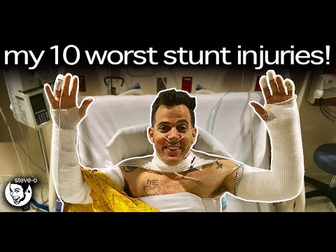 My Ten Worst Stunt Injuries | Steve-O thumbnail