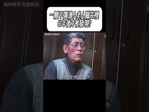 一顆子彈進入老人腦袋裡，60年後才被發現?#科普 #漲知識 thumbnail