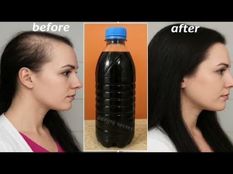 Spray it on your hair for just 2 days and your hair will grow 3 times faster. thumbnail