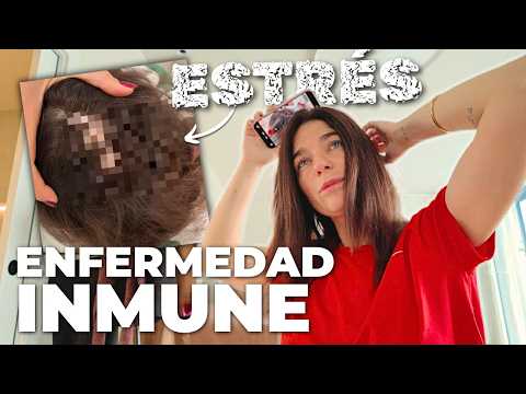 TENGO UNA ENFERMEDAD INMUNE QUE ME HA APARECIDO POR EL ESTRÉS! UN #vlog MUY PERSONAL @BonbonReich thumbnail