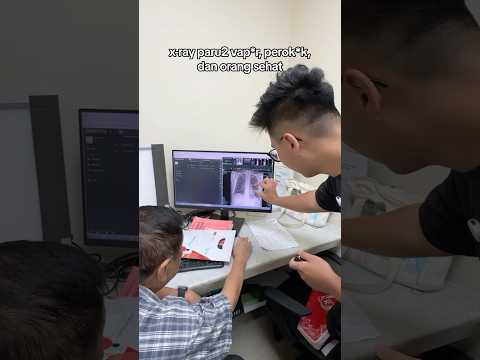 Cek paru2 pake XRAY! thumbnail