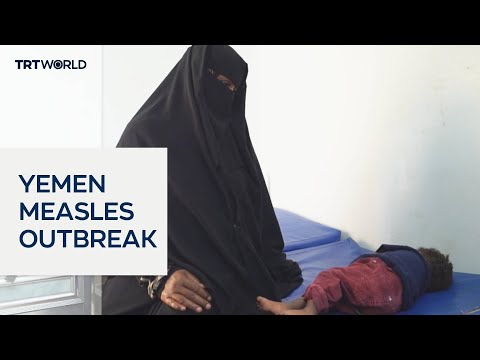 Yemen battling renewed measles outbreak thumbnail