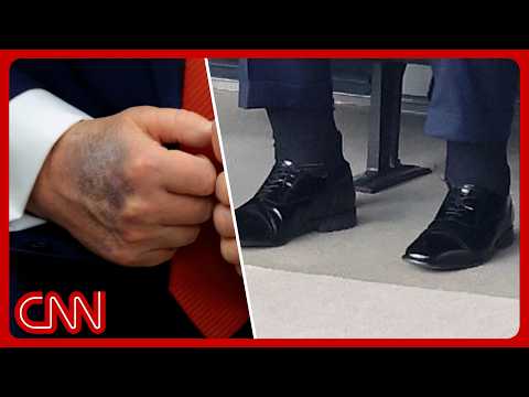 After 3 days of silence, WH releases Trump medical report thumbnail
