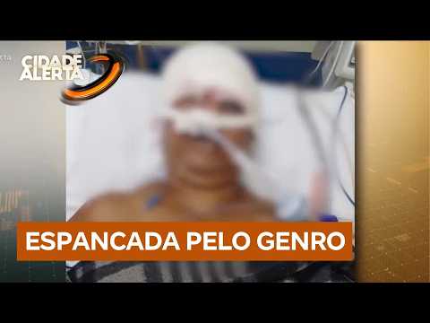 Homem invade casa e agride sogra em Itu (SP); vítima está internada thumbnail