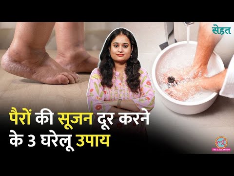 Leg Swelling का कनेक्शन Heart, Kidney, Arthritis से कब? पैरों की सूजन ऐसे दूर करें | Sehat | LIVE thumbnail