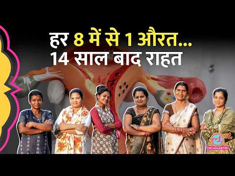 PCOS अब कहलाएगा PMOS, ऐसा क्यों किया गया, Symptoms, Treatment का तरीका बदलेगा? Doctor ने बता दिया thumbnail