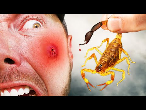 PAINFUL STING From One of Asia's Meanest Scorpions! thumbnail