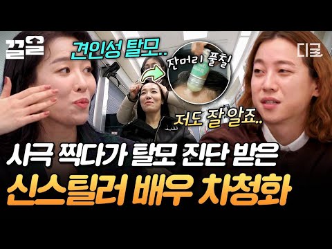 [#온앤오프] 상궁 역할 하다가 탈모 고민 생겼다?? 배우 차청화가 털어놓은 사극 촬영 비하인드? thumbnail