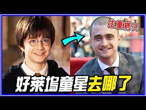 病到差點演不了戲！5位好萊塢超紅童星30年後的現況 thumbnail