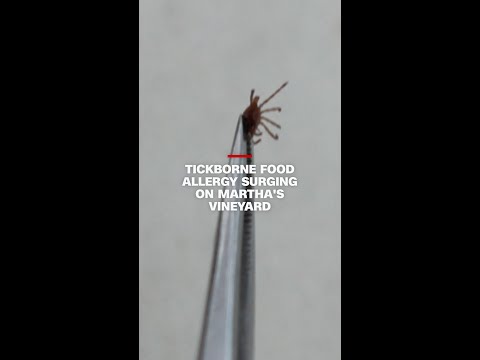 Tickborne food allergy surging on Martha’s Vineyard thumbnail
