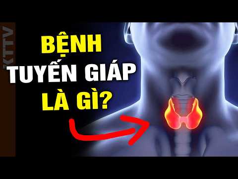 Giải thích về bệnh Tuyến giáp dễ hiểu trong 8 phút thumbnail