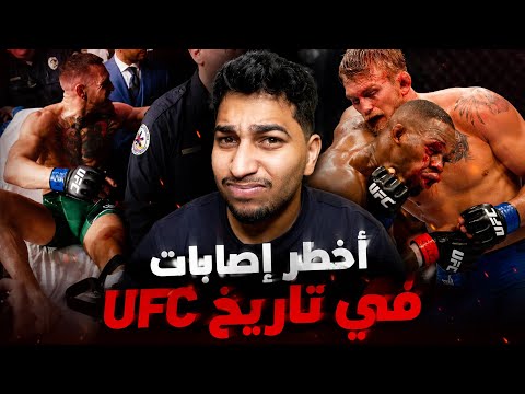 أسوأ الإصابات في فنون القتال المختلطة | الجانب المظلم من UFC thumbnail
